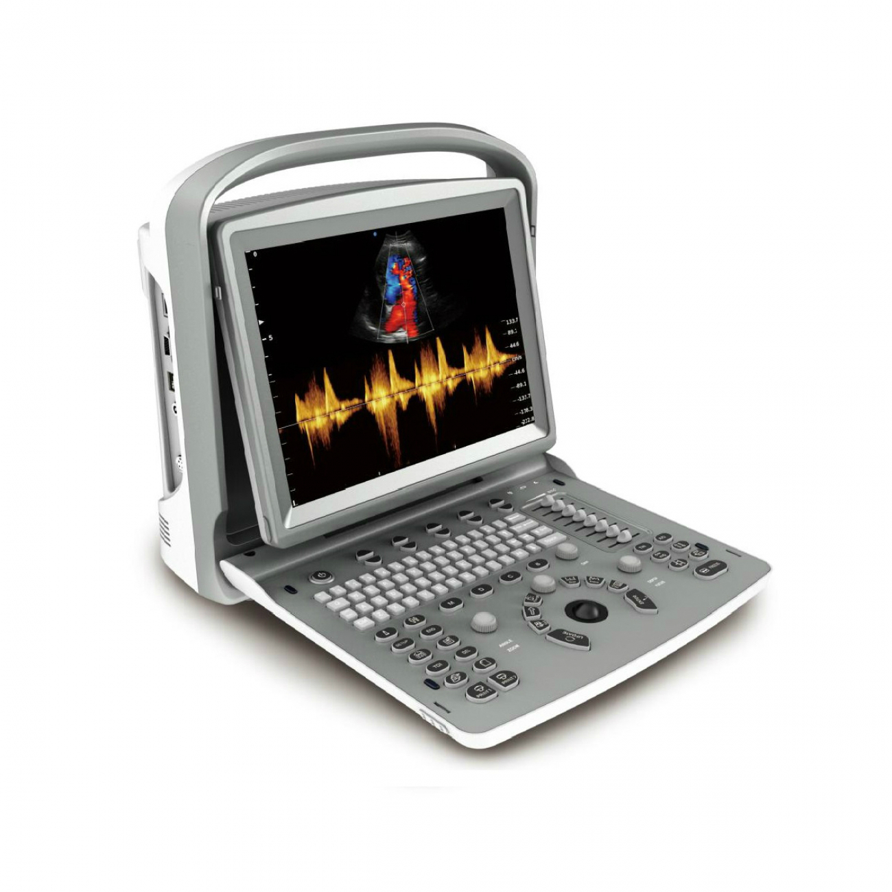 Chison Sonotouch 50 (ECO5)