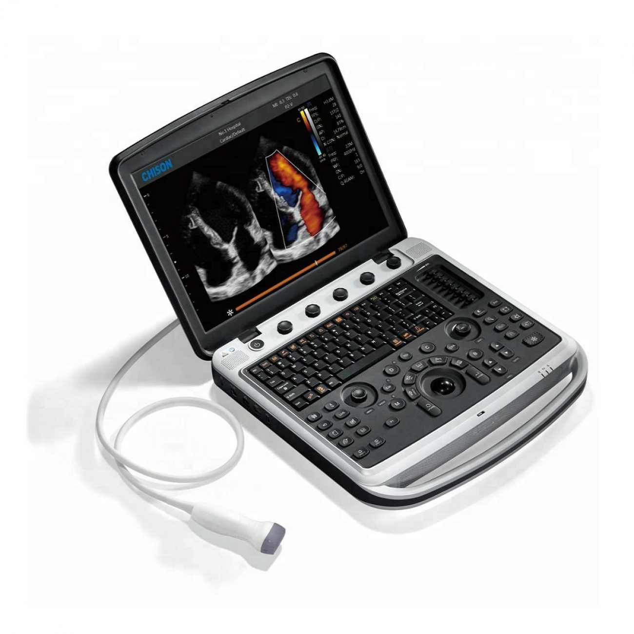 Chison Sonotouch 80