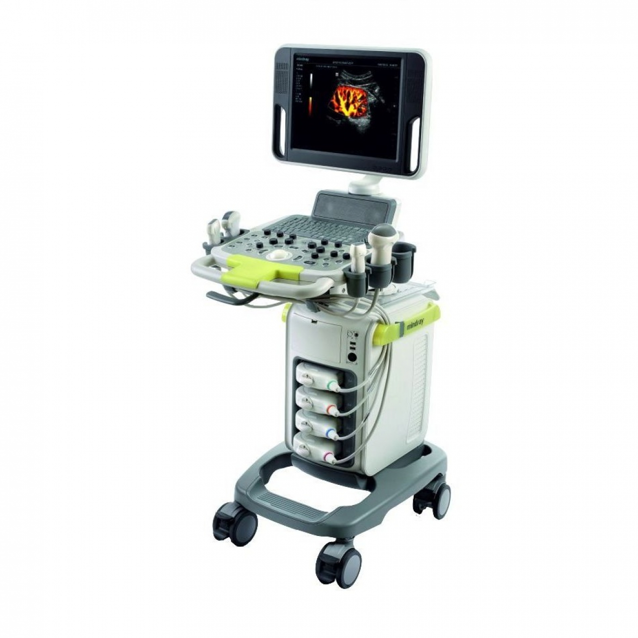 Mindray DC-N3