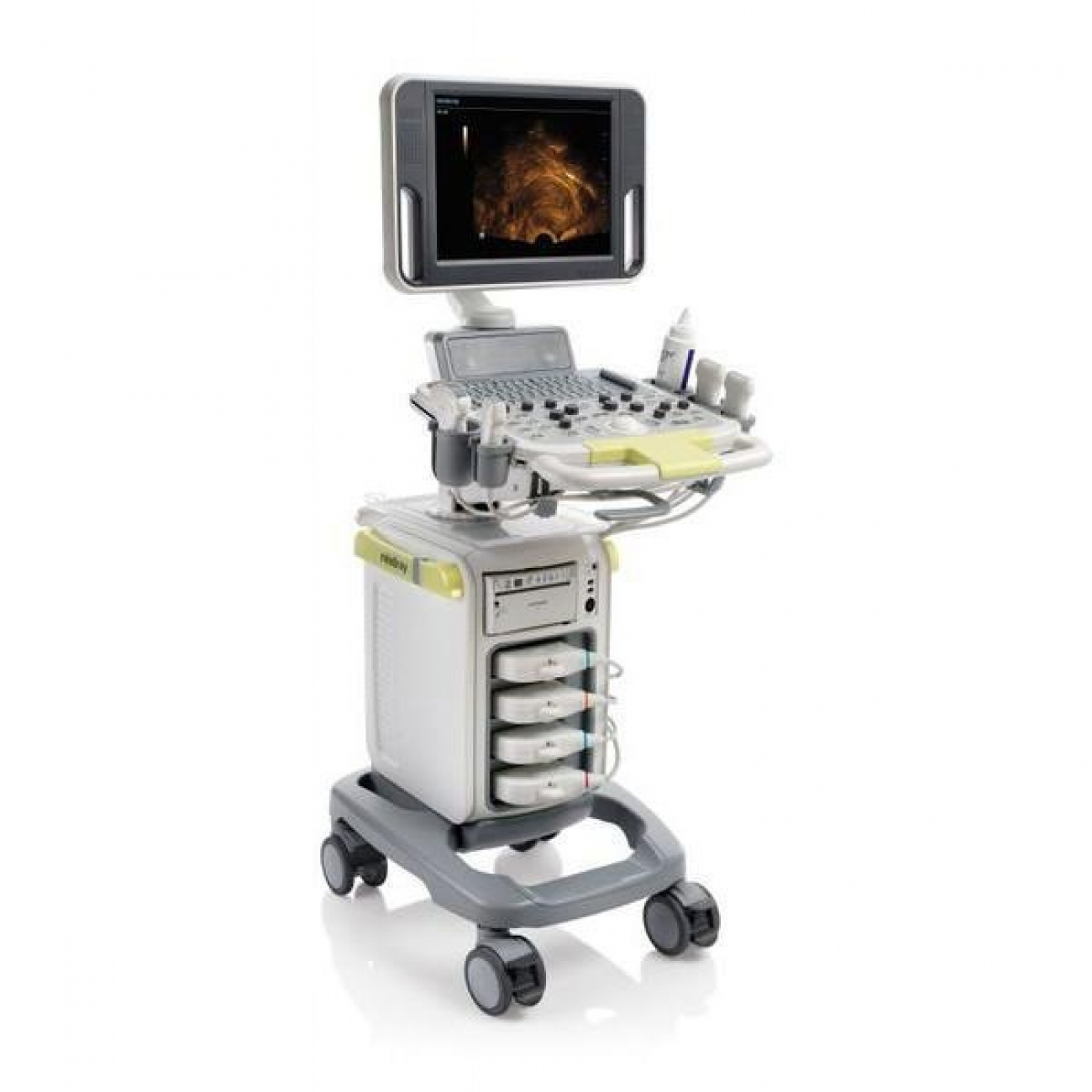 Mindray DC-N3