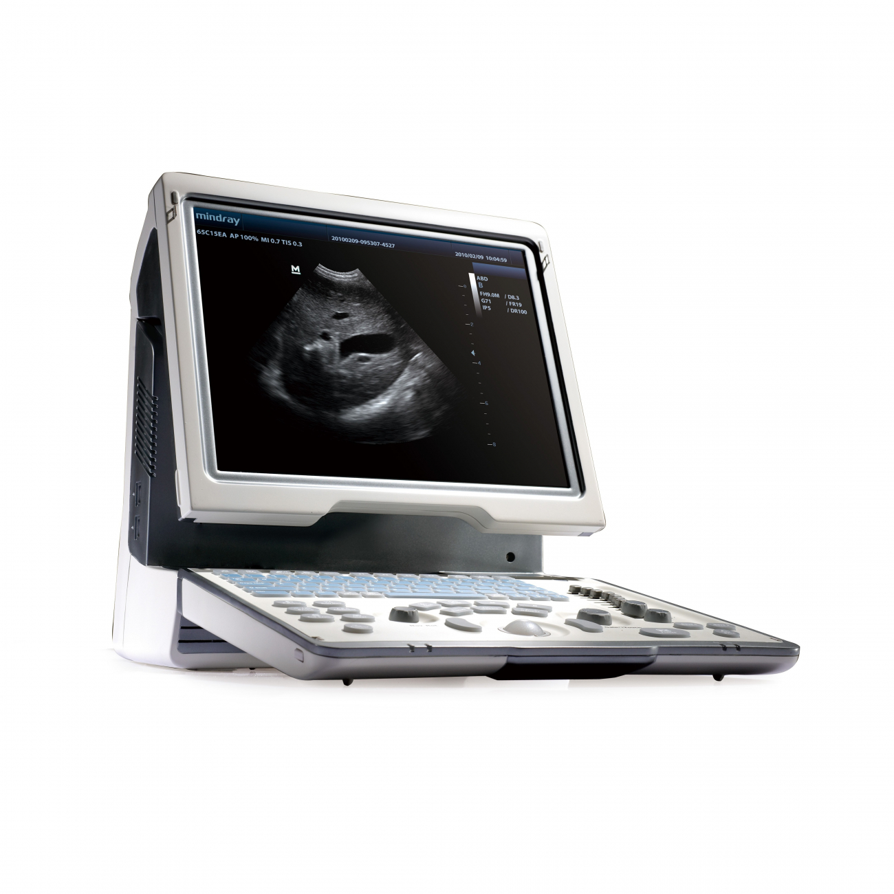 Mindray DP-50
