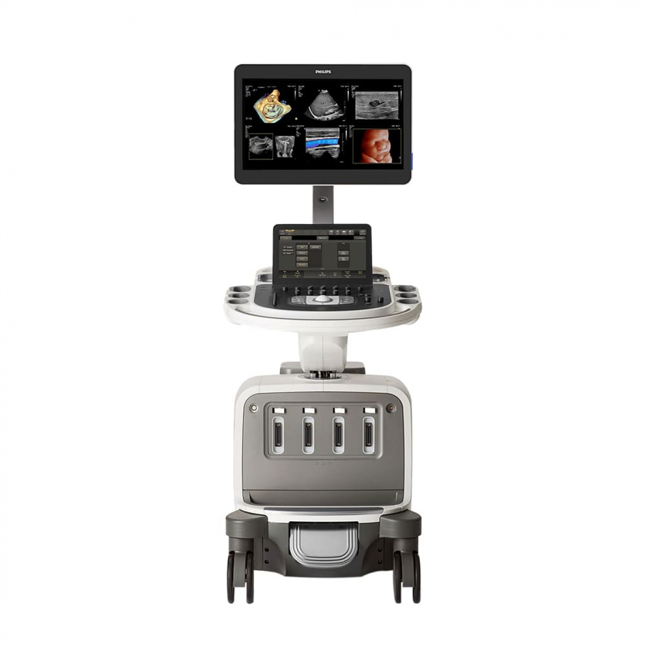 Philips EPIQ CVX